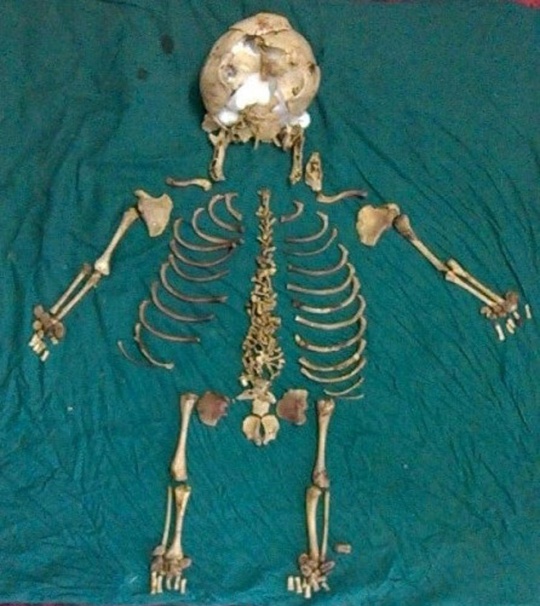 foetus Skeleton