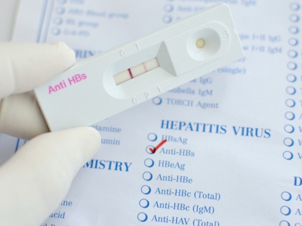 living with hepatitis c a viral infection of epidemic proportions living with hepatitis c a viral infection of epidemic proportions
