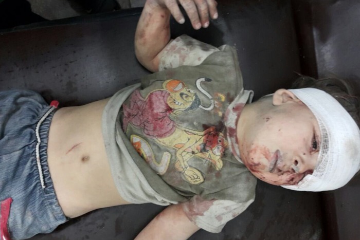 Omran Daqneesh Omran Daqneesh