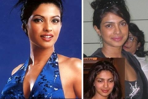 Priyanka Chopra's UGLY Photos - Indiatimes.com