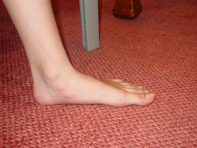 flatfoot_1456233976.jpg