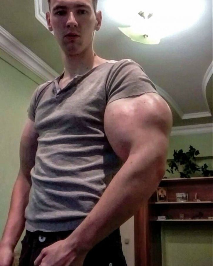 Kirill Tereshin, The ‘Russian Popeye’ Faces The Risk Of Kirill Tereshin, The ‘Russian Popeye’ Faces The Risk Of