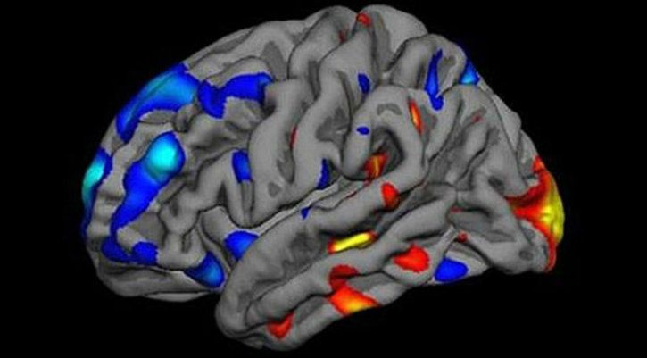 brain tumour scan mri