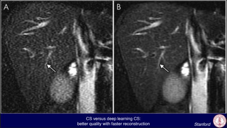 stanford medical school mri scan artificial intelligence with machine learning healthcare stanford medical school mri scan artificial intelligence with machine learning healthcare