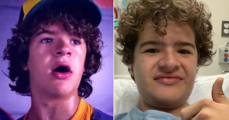 Stranger Things Star Gaten Matarazzo Shares Pic Before 4th Surgery For Cleidocranial Dysplasia 4113