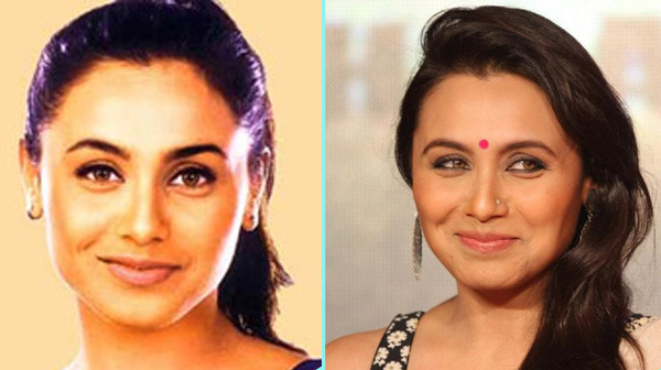 worst-celebrity-nose-jobs-indiatimes