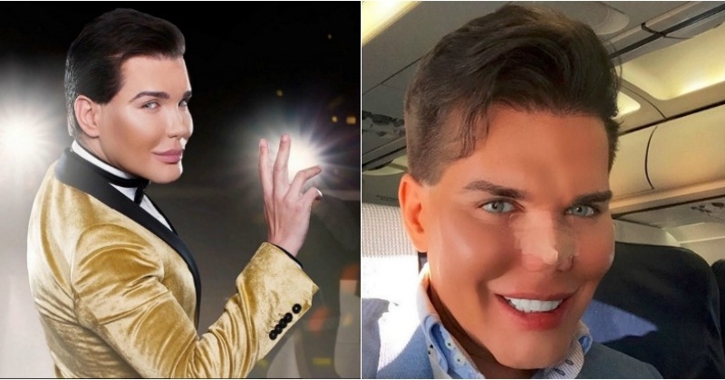 Meet Rodrigo Alves, A Plastic Surgery Addict Who Has Been Hospitalised 