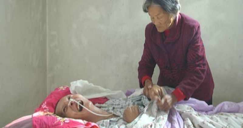 Wei Mingying merawat anaknya yang baru bangun dari koma, Wang Shubao (Photo: Jining News via Indiatimes.com)