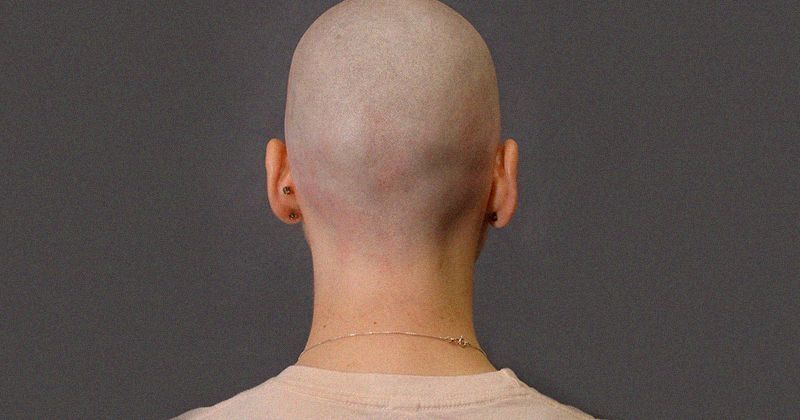 Dad Shaves Daughters Headdad Asks 16 Yo Daughter To Shave Her Head After She Teases Pulls Off 