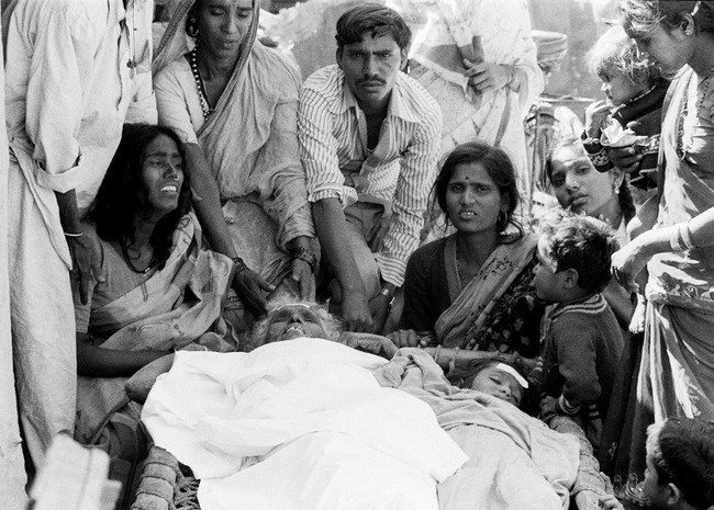 Scars of the Bhopal Gas Tragedy - Indiatimes.com